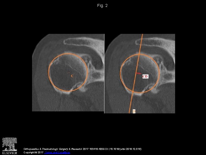 Fig. 2 Orthopaedics & Traumatology: Surgery & Research 2017 103415 -420 DOI: (10. 1016/j.