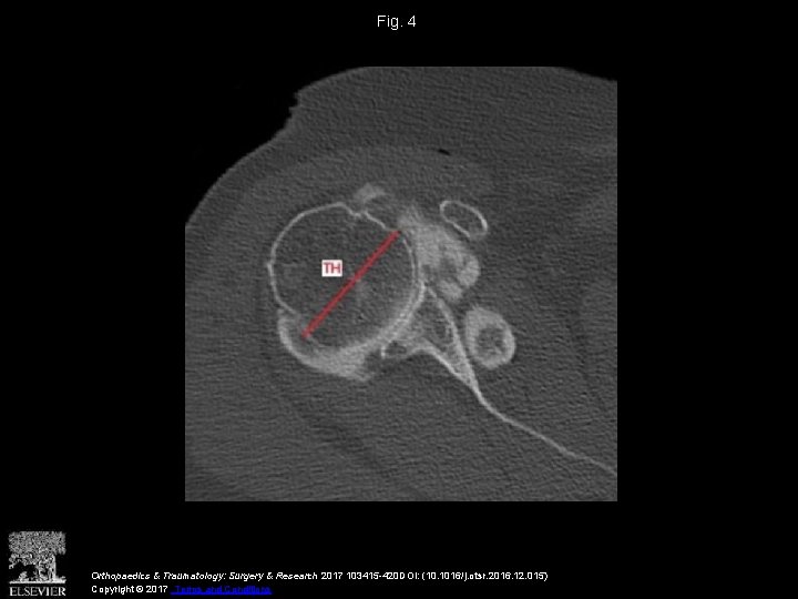 Fig. 4 Orthopaedics & Traumatology: Surgery & Research 2017 103415 -420 DOI: (10. 1016/j.