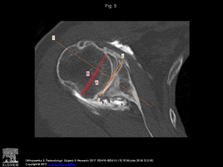 Fig. 5 Orthopaedics & Traumatology: Surgery & Research 2017 103415 -420 DOI: (10. 1016/j.