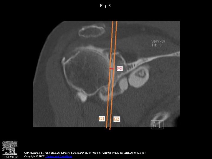 Fig. 6 Orthopaedics & Traumatology: Surgery & Research 2017 103415 -420 DOI: (10. 1016/j.