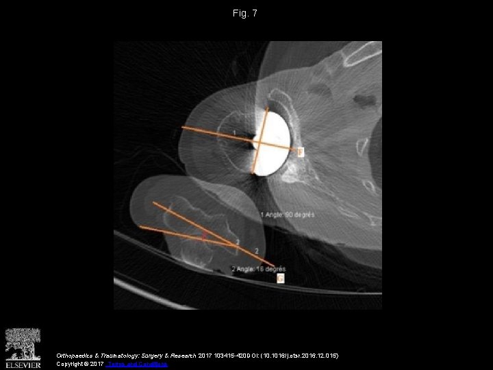 Fig. 7 Orthopaedics & Traumatology: Surgery & Research 2017 103415 -420 DOI: (10. 1016/j.