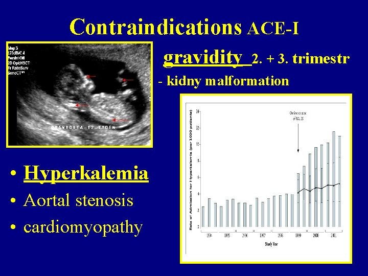 Contraindications ACE-I gravidity 2. + 3. trimestr - kidny malformation • Hyperkalemia • Aortal