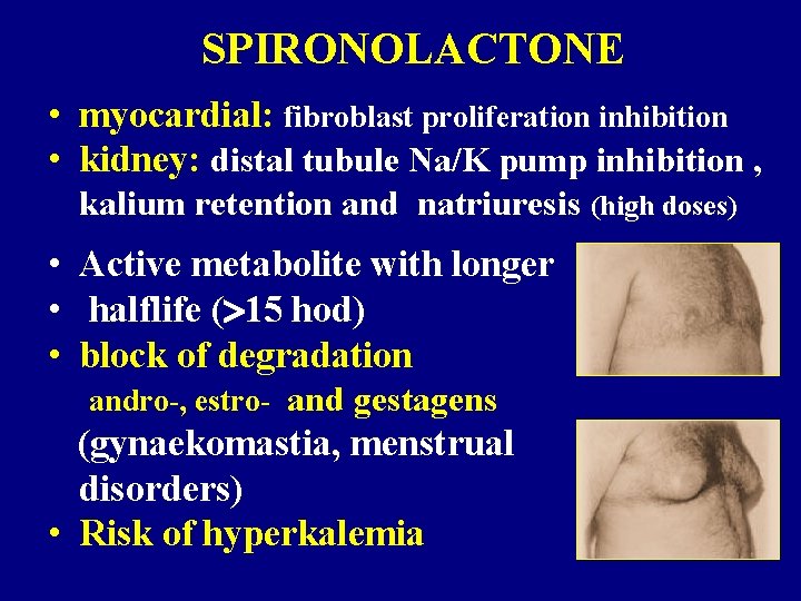 SPIRONOLACTONE • myocardial: fibroblast proliferation inhibition • kidney: distal tubule Na/K pump inhibition ,