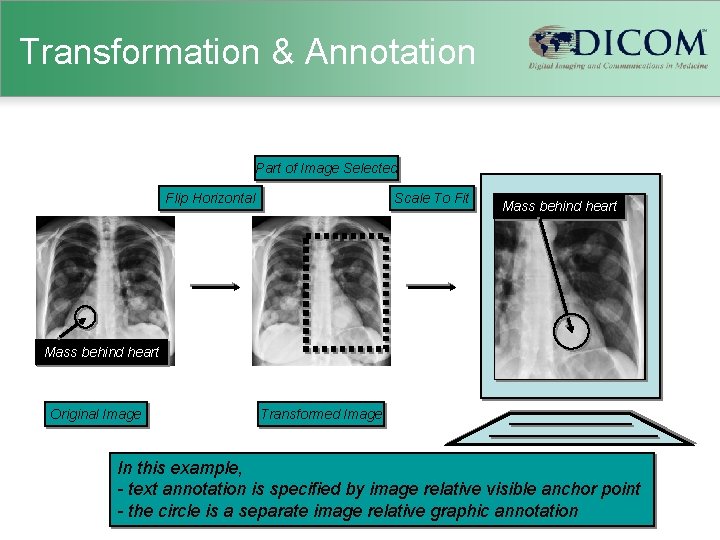 Transformation & Annotation Part of Image Selected Flip Horizontal Scale To Fit Mass behind