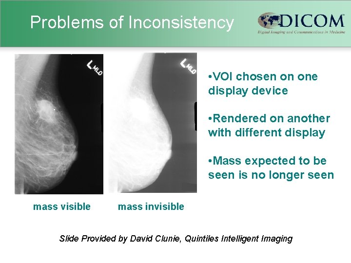 Problems of Inconsistency • VOI chosen on one display device • Rendered on another