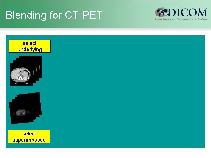 Blending for CT-PET select underlying select superimposed 