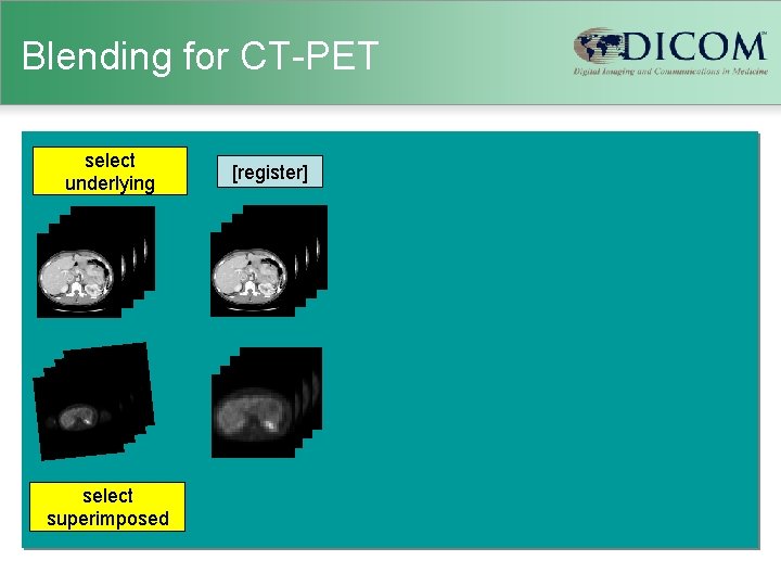 Blending for CT-PET select underlying select superimposed [register] 