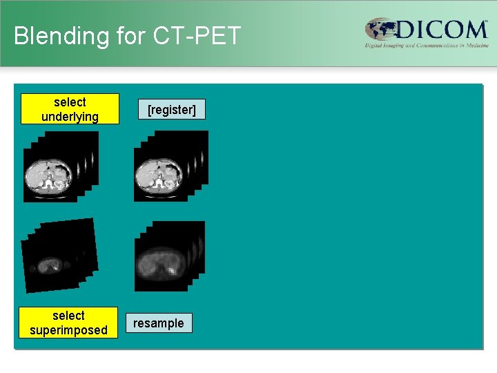 Blending for CT-PET select underlying select superimposed [register] resample 