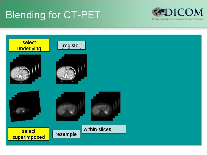 Blending for CT-PET select underlying select superimposed [register] resample within slices 