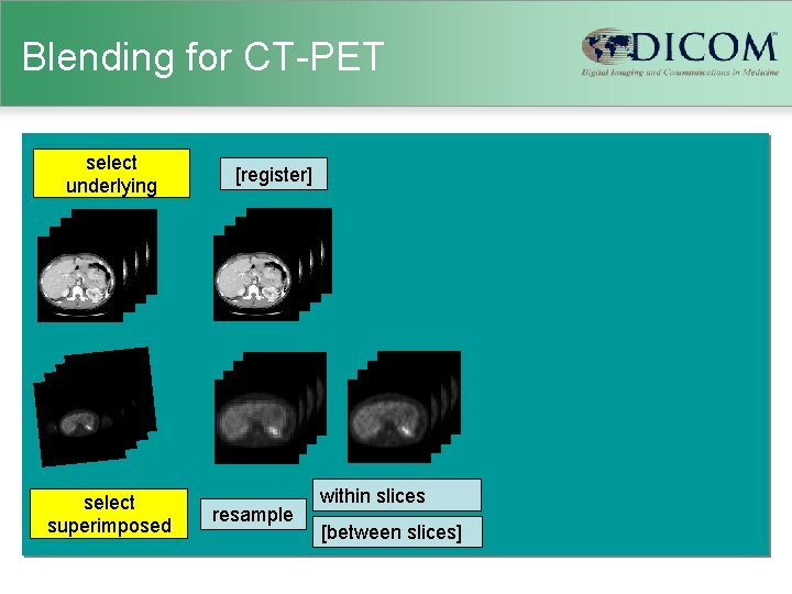 Blending for CT-PET select underlying select superimposed [register] resample within slices [between slices] 