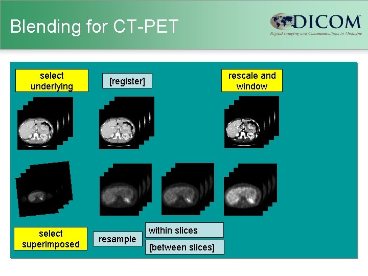 Blending for CT-PET select underlying select superimposed rescale and window [register] resample within slices