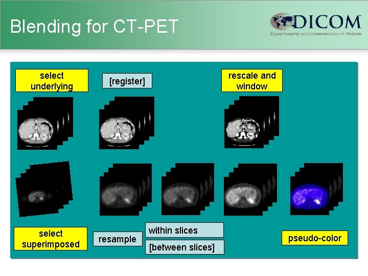 Blending for CT-PET select underlying select superimposed rescale and window [register] resample within slices