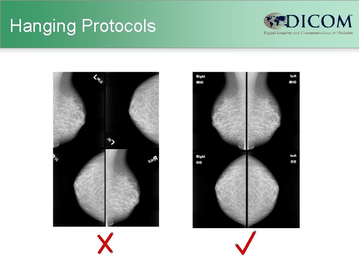 Hanging Protocols 