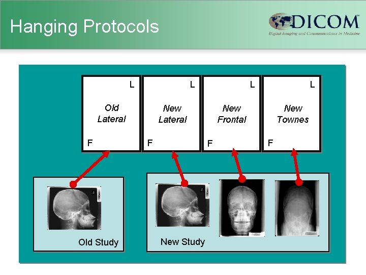 Hanging Protocols L L Old Lateral F Old Study L New Frontal New Lateral