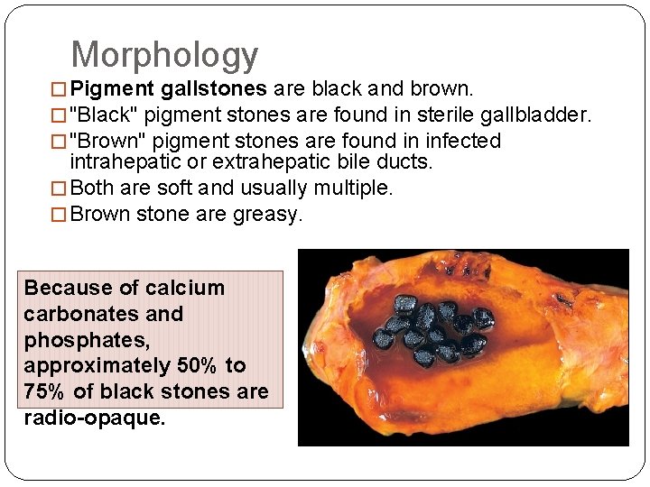 Morphology � Pigment gallstones are black and brown. � "Black" pigment stones are found Morphology � Pigment gallstones are black and brown. � "Black" pigment stones are found