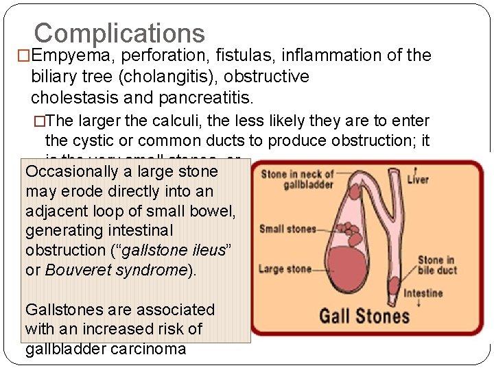 Complications �Empyema, perforation, fistulas, inflammation of the biliary tree (cholangitis), obstructive cholestasis and pancreatitis. Complications �Empyema, perforation, fistulas, inflammation of the biliary tree (cholangitis), obstructive cholestasis and pancreatitis.
