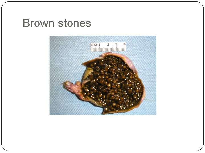 Brown stones Brown stones