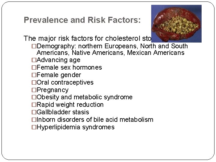Prevalence and Risk Factors: The major risk factors for cholesterol stone are: �Demography: northern Prevalence and Risk Factors: The major risk factors for cholesterol stone are: �Demography: northern