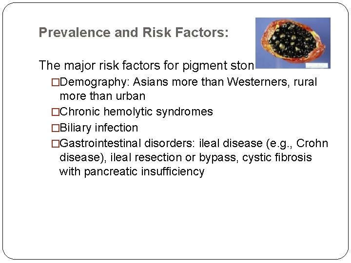Prevalence and Risk Factors: The major risk factors for pigment stone are: �Demography: Asians Prevalence and Risk Factors: The major risk factors for pigment stone are: �Demography: Asians