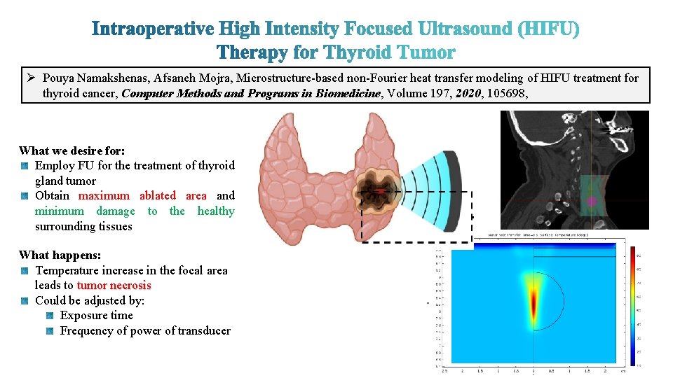 Ø Pouya Namakshenas, Afsaneh Mojra, Microstructure-based non-Fourier heat transfer modeling of HIFU treatment for