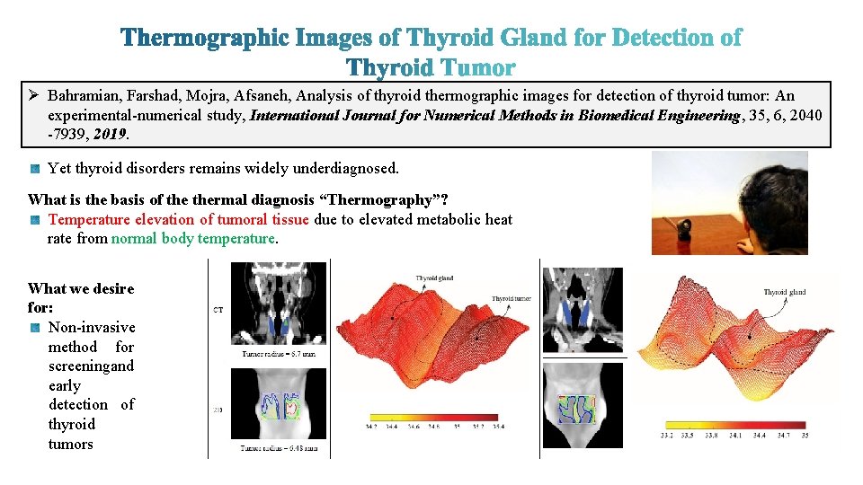 Ø Bahramian, Farshad, Mojra, Afsaneh, Analysis of thyroid thermographic images for detection of thyroid