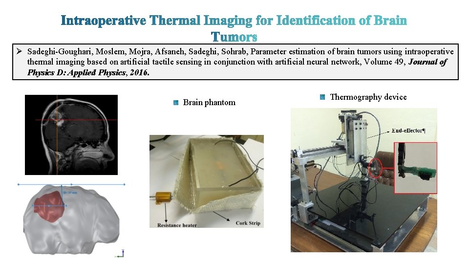 Ø Sadeghi-Goughari, Moslem, Mojra, Afsaneh, Sadeghi, Sohrab, Parameter estimation of brain tumors using intraoperative