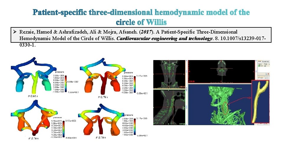 Ø Rezaie, Hamed & Ashrafizadeh, Ali & Mojra, Afsaneh. (2017). A Patient-Specific Three-Dimensional Hemodynamic