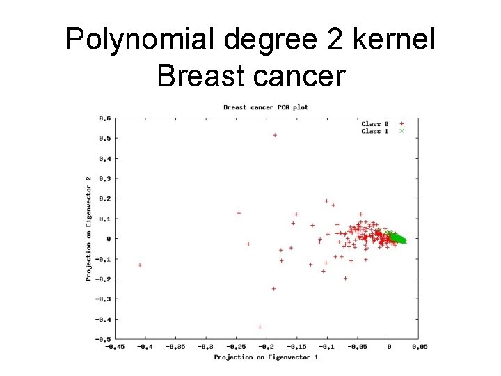 Polynomial degree 2 kernel Breast cancer 