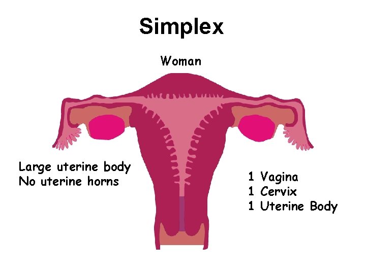 Simplex Woman Large uterine body No uterine horns 1 Vagina 1 Cervix 1 Uterine