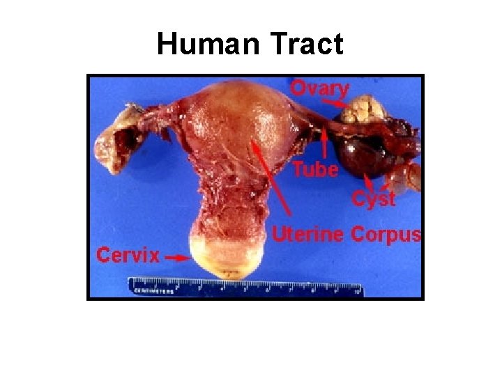 Human Tract 