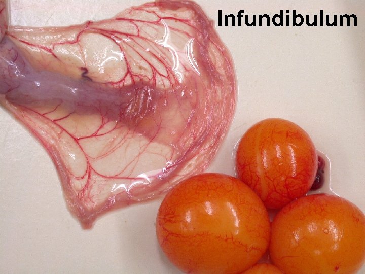 Infundibulum 