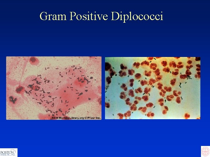 Gram Positive Diplococci 