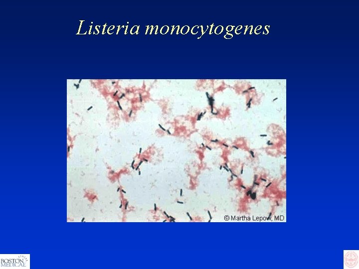 Listeria monocytogenes 