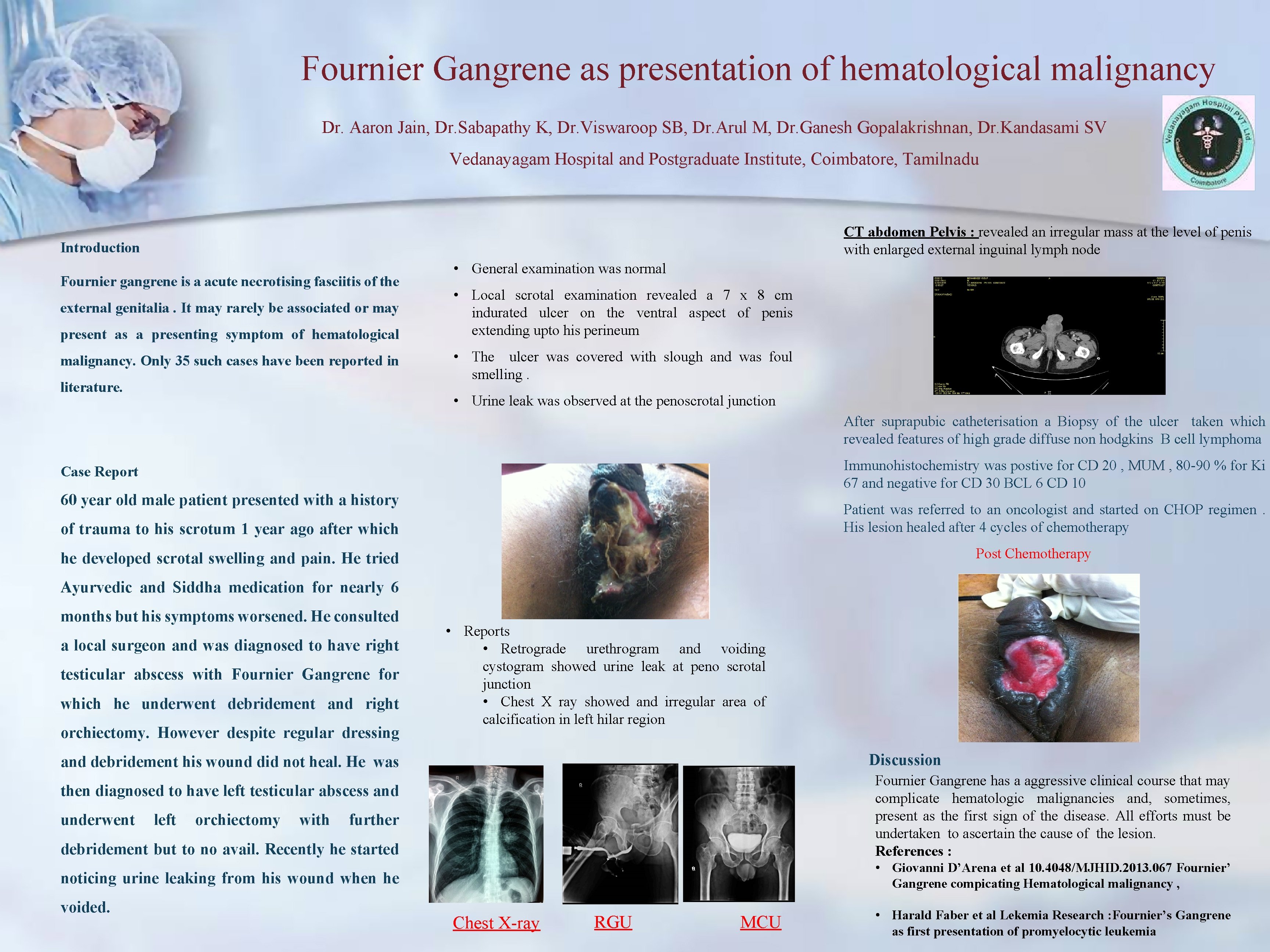 Fournier Gangrene as presentation of hematological malignancy Dr. Aaron Jain, Dr. Sabapathy K, Dr.