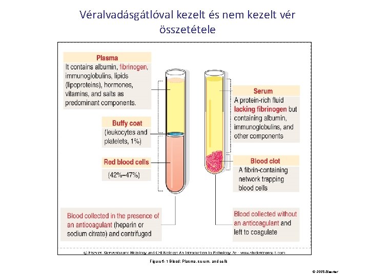 Véralvadásgátlóval kezelt és nem kezelt vér összetétele Figure 6 -1 Blood: Plasma, serum, and