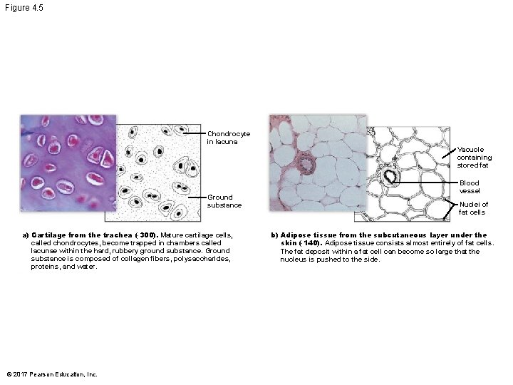 Figure 4. 5 Chondrocyte in lacuna Vacuole containing stored fat Ground substance a) Cartilage Figure 4. 5 Chondrocyte in lacuna Vacuole containing stored fat Ground substance a) Cartilage