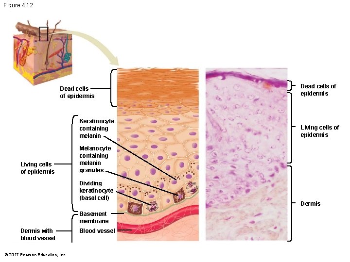 Figure 4. 12 Dead cells of epidermis Keratinocyte containing melanin Living cells of epidermis Figure 4. 12 Dead cells of epidermis Keratinocyte containing melanin Living cells of epidermis