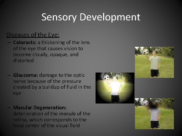 Sensory Development Diseases of the Eye: – Cataracts: a thickening of the lens of