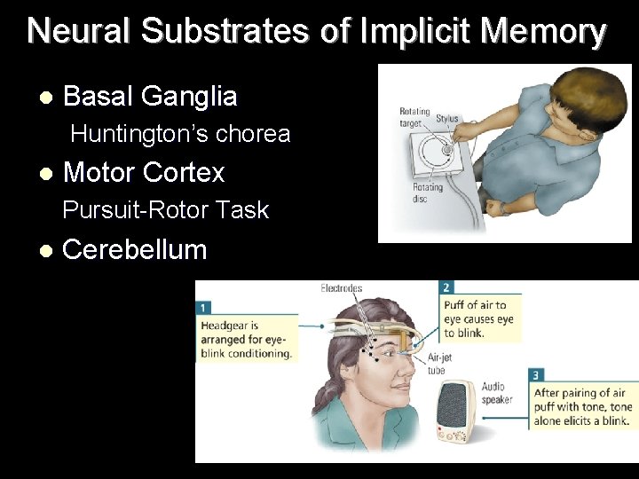 Neural Substrates of Implicit Memory l Basal Ganglia Huntington’s chorea l Motor Cortex Pursuit-Rotor