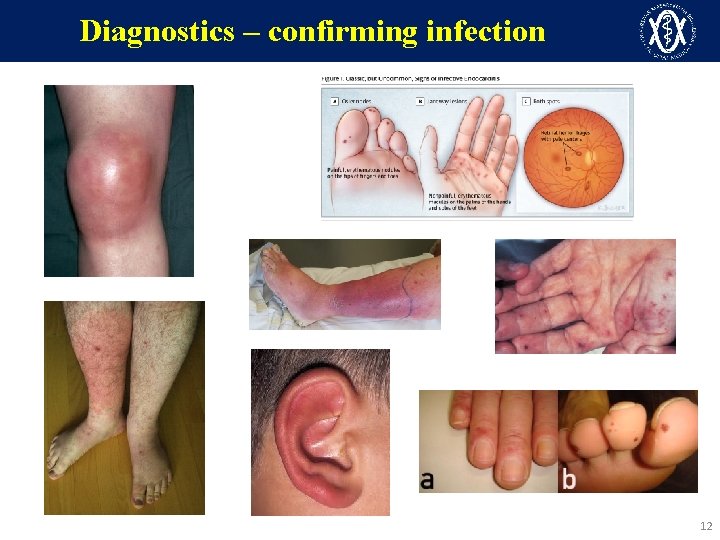 Diagnostics – confirming infection 12 