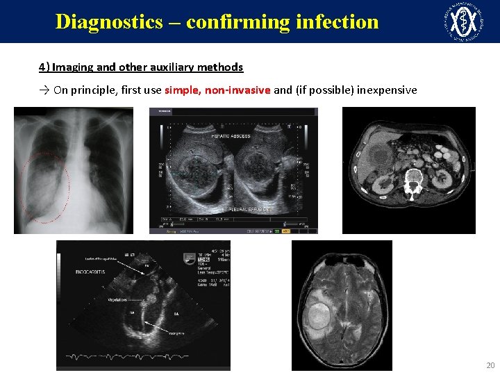 Diagnostics – confirming infection 4) Imaging and other auxiliary methods → On principle, first