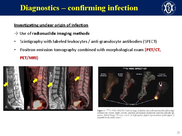 Diagnostics – confirming infection Investigating unclear origin of infection → Use of radionuclide imaging