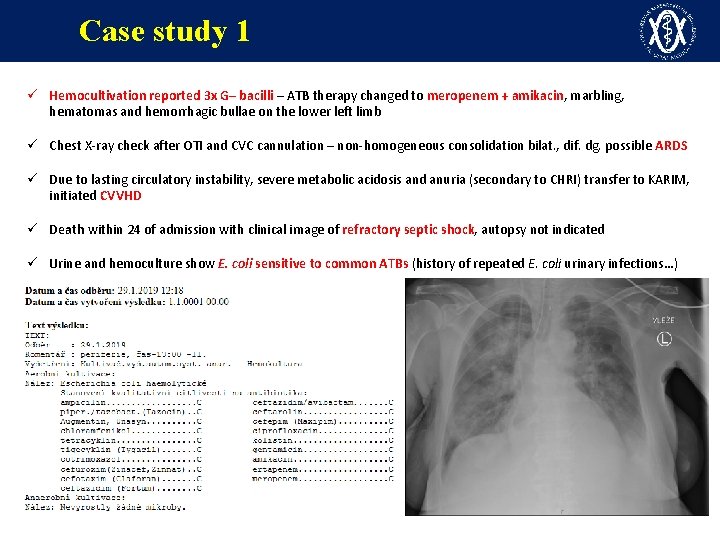 Case study 1 ü Hemocultivation reported 3 x G– bacilli – ATB therapy changed