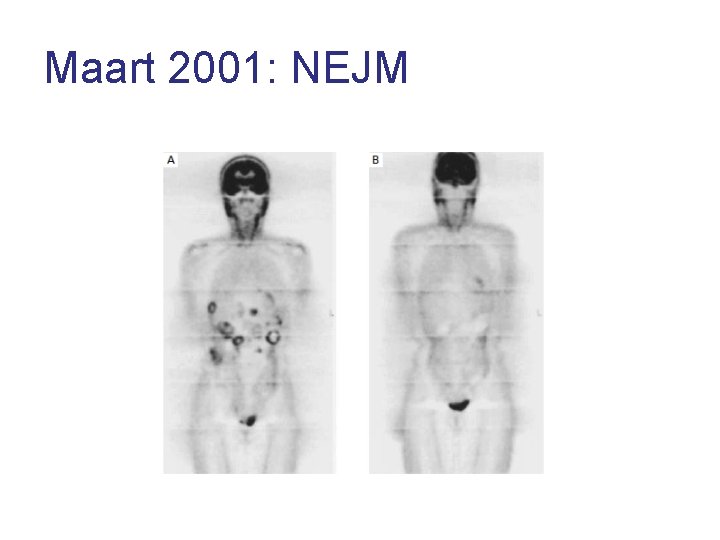 Maart 2001: NEJM 