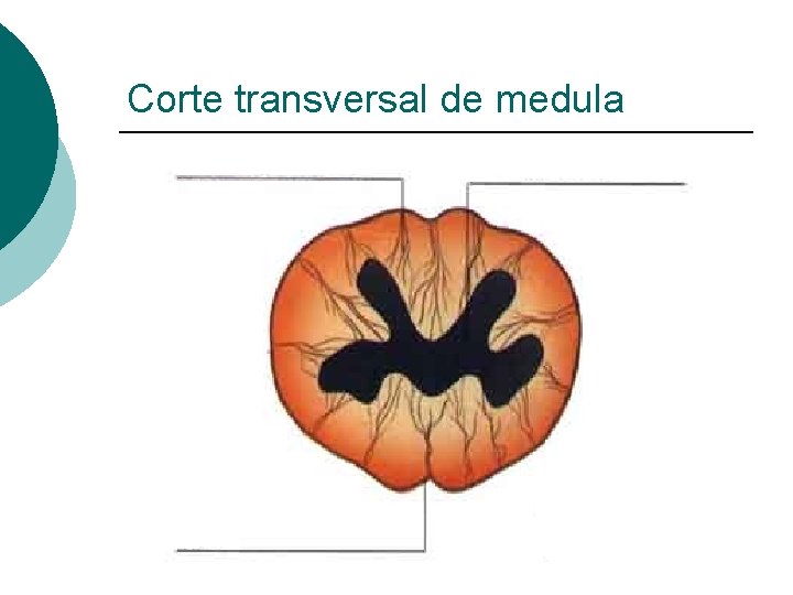 Corte transversal de medula 