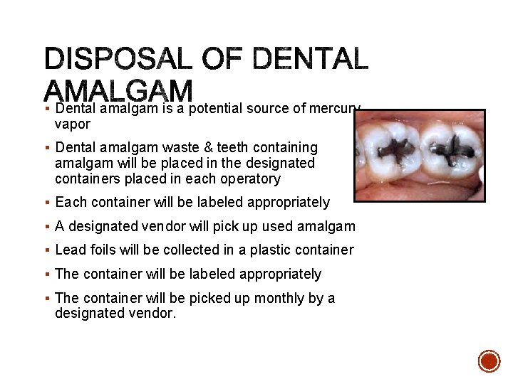 § Dental amalgam is a potential source of mercury vapor § Dental amalgam waste