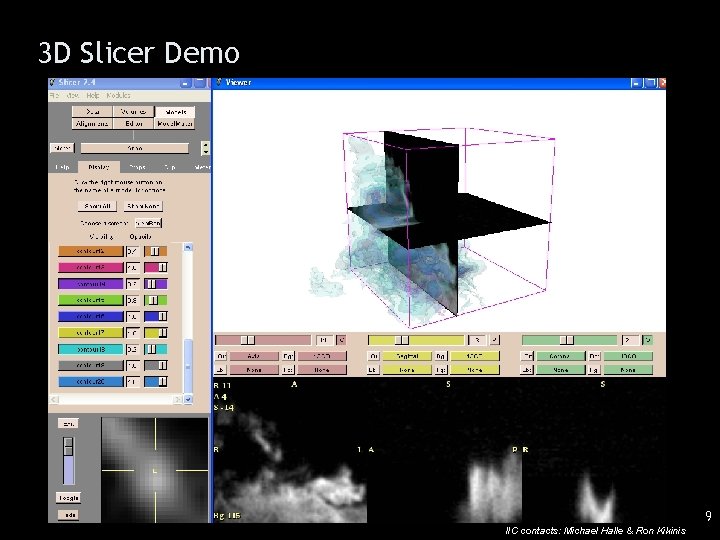 3 D Slicer Demo 9 IIC contacts: Michael Halle & Ron Kikinis 