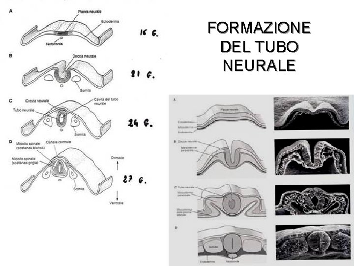 FORMAZIONE DEL TUBO NEURALE 