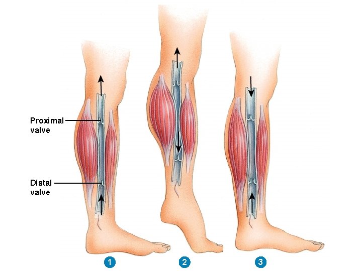 Proximal valve Distal valve 1 2 3 