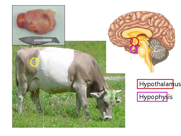 Hypothalamus Hypophysis 